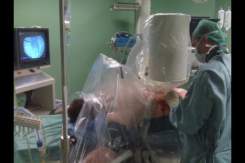 Endoskopowe operacje kręgosłupa w Nowym Targu